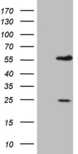 MNDA Antibody (OTI4H6), Novus Biologicals 0.1mL; Unlabeled:Antibodies,