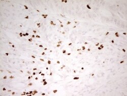 MNDA Antibody (OTI4H6), Novus Biologicals 0.1mL; Unlabeled:Antibodies,