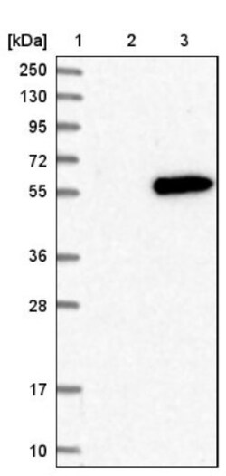 MNK2 Antibody, Novus Biologicals 0.1mL; Unlabeled:Antibodies, Polyclonal