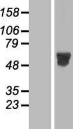 Novus Biologicals&trade;&nbsp;MNK2 Overexpression Lysate