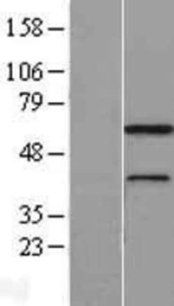 Novus Biologicals&trade;&nbsp;MNS1 Overexpression Lysate