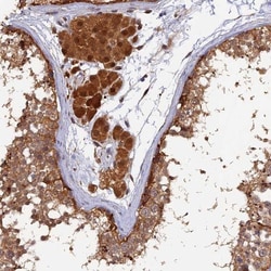 MNS1 Antibody, Novus Biologicals:Antibodies:Primary Antibodies