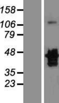 Novus Biologicals™ MNX1/HLXB9 Overexpression Lysate