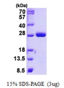 Novus Biologicals&trade;&nbsp;Recombinant Human MOB4A His Protein