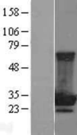 Novus Biologicals&trade;&nbsp;MOBKL2B Overexpression Lysate