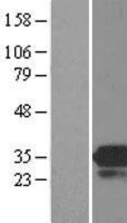 Novus Biologicals™ MOBKL3 Overexpression Lysate