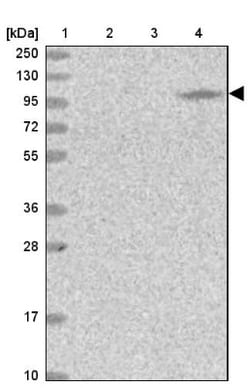 MOCOS Antibody, Novus Biologicals 25 &mu;L, Unlabeled:Antibodies, Polyclonal