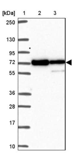 MOCS1 Antibody, Novus Biologicals 25 &mu;L, Unlabeled:Antibodies, Polyclonal