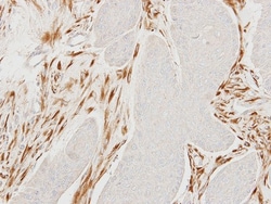 MOCS2 Antibody, Novus Biologicals 0.1mL; Unlabeled:Antibodies, Polyclonal