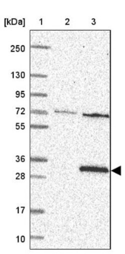 MOCS2 Antibody, Novus Biologicals 0.1mL; Unlabeled:Antibodies, Polyclonal