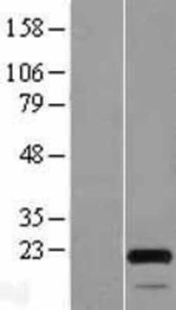 Novus Biologicals MOCS2 Overexpression Lysate 0.1 mg | Buy Online | Novus Biologicals&trade; | Fisher Scientific