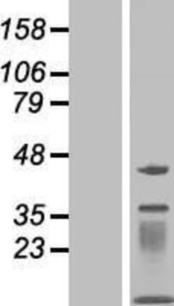 Novus Biologicals&trade;&nbsp;MOCS2 Overexpression Lysate