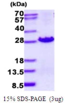 Novus Biologicals&trade;&nbsp;Recombinant Human MOCS2 His Protein
