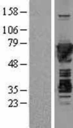 Novus Biologicals&trade;&nbsp;Moesin Overexpression Lysate