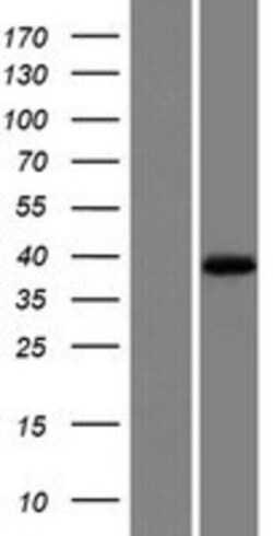 Novus Biologicals&trade;&nbsp;MOGAT1 Overexpression Lysate