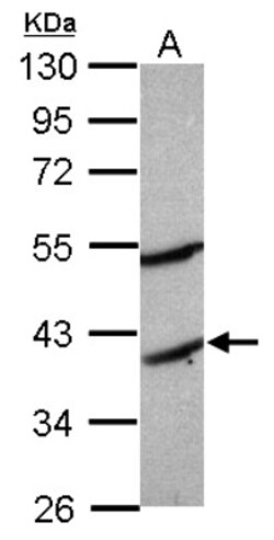 MOGAT2 Antibody, Novus Biologicals 0.1mL; Unlabeled:Antibodies, Polyclonal