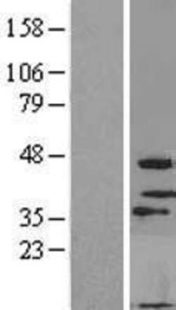 Novus Biologicals&trade;&nbsp;MOGAT3 Overexpression Lysate