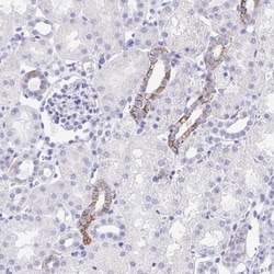MON1A Antibody, Novus Biologicals 25 &mu;L, Unlabeled:Antibodies, Polyclonal