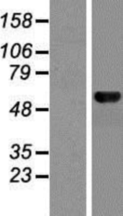 Novus Biologicals&trade;&nbsp;MON1B Overexpression Lysate