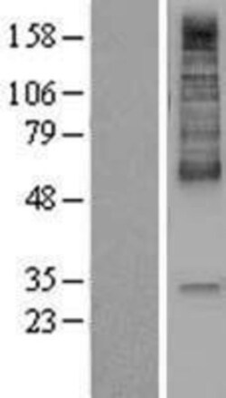 Novus Biologicals&trade;&nbsp;MCT1/SLC16A1 Overexpression Lysate