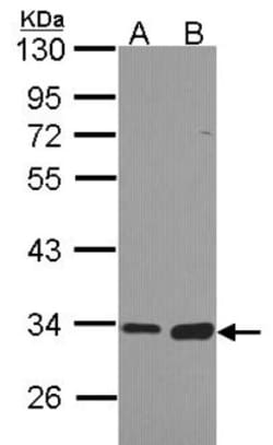 Monoglyceride Lipase Antibody, Novus Biologicals 0.1mL; Unlabeled:Antibodies,
