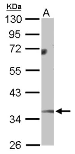 Monoglyceride Lipase Antibody, Novus Biologicals 0.1mL; Unlabeled:Antibodies,