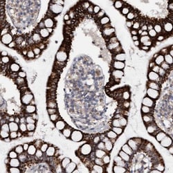 Monoglyceride Lipase Antibody, Novus Biologicals 0.1mL; Unlabeled:Antibodies,