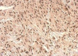 Monoglyceride Lipase Antibody, Novus Biologicals 0.1mL; Unlabeled:Antibodies,