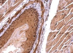 Monoglyceride Lipase Antibody, Novus Biologicals 0.1mL; Unlabeled:Antibodies,