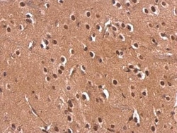 Monoglyceride Lipase Antibody, Novus Biologicals 0.1mL; Unlabeled:Antibodies,