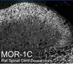 MOR-1C Antibody 0.05mL; Unlabeled:Antibodies, Polyclonal