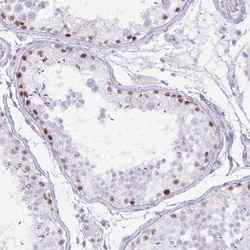 MORC4 Antibody, Novus Biologicals:Antibodies:Primary Antibodies