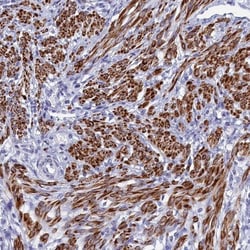 Morg1 Antibody, Novus Biologicals 25 &mu;L, Unconjugated:Antibodies, Polyclonal