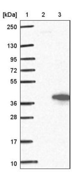 Morg1 Antibody, Novus Biologicals 25 &mu;L | Buy Online | Novus Biologicals | Fisher Scientific