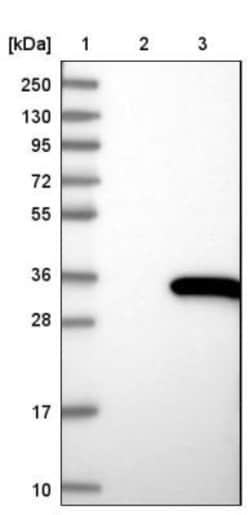 MORN3 Antibody, Novus Biologicals 0.1mL; Unlabeled:Antibodies, Polyclonal