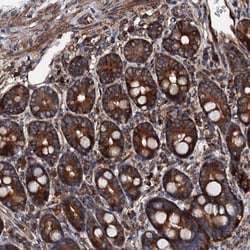 MOS Antibody, Novus Biologicals 25 &mu;L; Unlabeled:Antibodies, Polyclonal