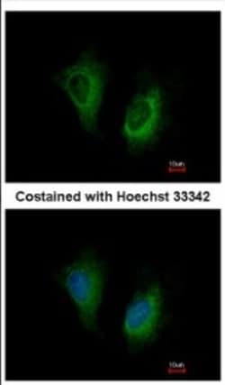 MOSC2 Antibody, Novus Biologicals 0.1mL; Unlabeled:Anticuerpos