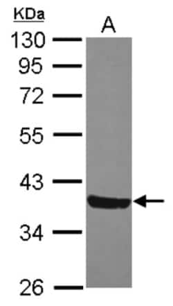 MOSC2 Antibody, Novus Biologicals 0.1mL; Unlabeled:Anticuerpos