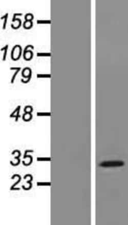 Novus Biologicals&trade;&nbsp;MOSPD3 Overexpression Lysate