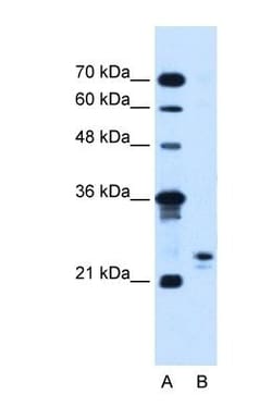 MOSPD3 Antibody, Novus Biologicals:Antibodies:Primary Antibodies