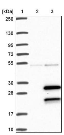 MOSPD3 Antibody, Novus Biologicals 0.1mL; Unlabeled:Antibodies, Polyclonal