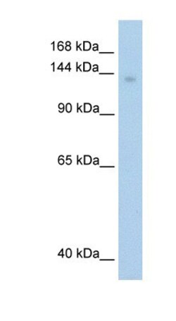 MOV10 Antibody, Novus Biologicals 100&mu;L; Unlabeled:Antibodies, Polyclonal