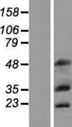 Novus Biologicals™ MOX1 Overexpression Lysate
