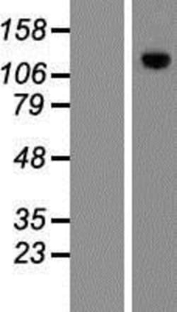 Novus Biologicals&trade;&nbsp;MPHOSPH9- Overexpression Lysate