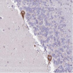 MPND Antibody, Novus Biologicals 25 &mu;L, Unlabeled:Antibodies, Polyclonal