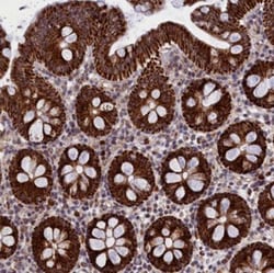 MPND Antibody, Novus Biologicals 0.1mL; Unlabeled:Antibodies, Polyclonal