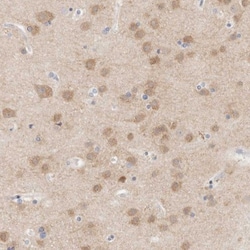 MPP2 Antibody, Novus Biologicals 25 &mu;L; Unlabeled:Antibodies, Polyclonal