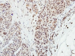MPP3 Antibody, Novus Biologicals 0.1mL; Unlabeled:Antibodies, Polyclonal