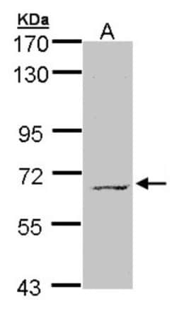 MPP3 Antibody, Novus Biologicals 0.1mL; Unlabeled:Antibodies, Polyclonal