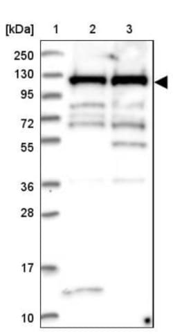 mpp8 Antibody, Novus Biologicals 25 &mu;L, Unconjugated:Anticuerpos